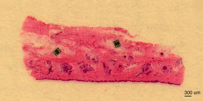 이미지마이크로봇03