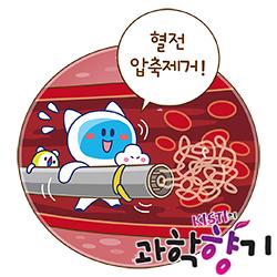 [과학향기 Story] 머리카락처럼 뭉쳐서 제거한다...혈전 치료의 혁신