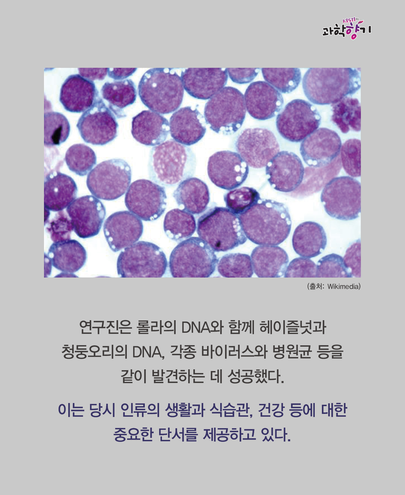 0108 껌으로 알아내는 인류 조상들의 삶 13